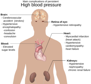 Geriatra em Campo Belo - MG - Hipertensão - Pressão Arterial - Pressão Alta - Anatomia